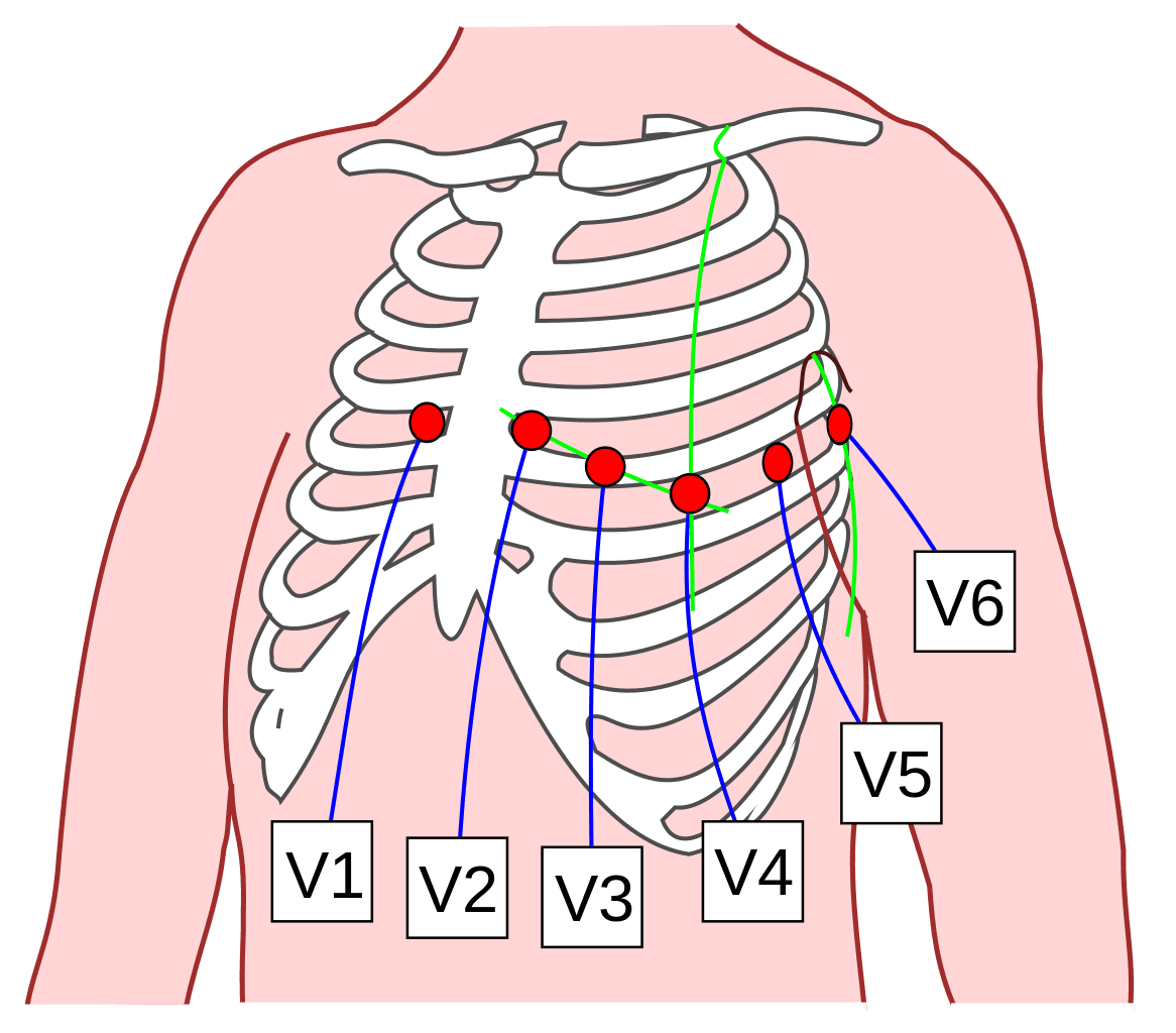 ECG Chest Lead Positions for 12 Lead ECG SimpleMed ECG Chest Lead Positions for 12 Lead ECG SimpleMed