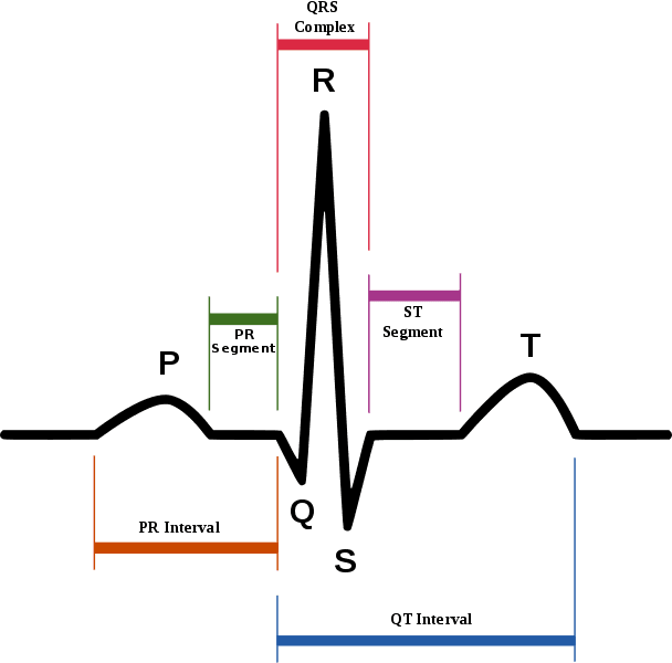 Sinus Rhythm ECG Intervals SimpleMed Sinus Rhythm ECG Intervals SimpleMed