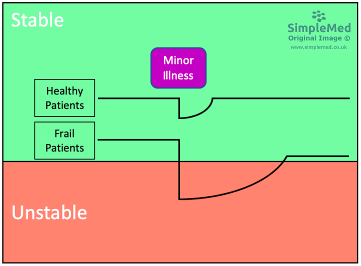 Frailty and the Effect of Minor Illness SimpleMed Frailty and the Effect of Minor Illness SimpleMed