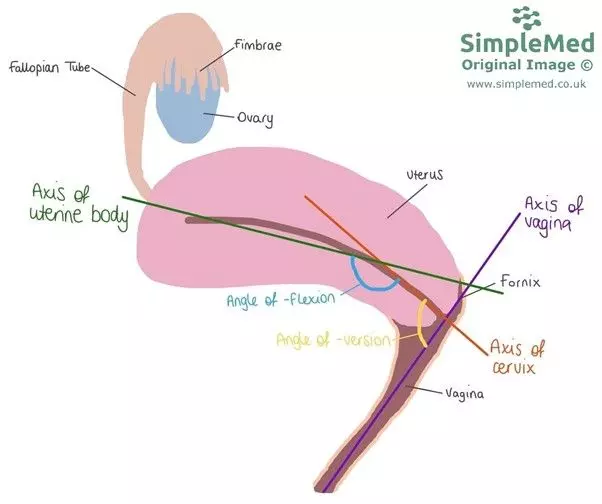 Angles of the Female Reproductive Tract SimpleMed Angles of the Female Reproductive Tract SimpleMed