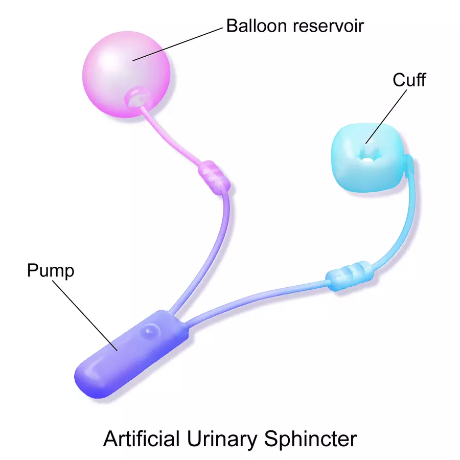 Artificial Urinary Sphincter SimpleMed