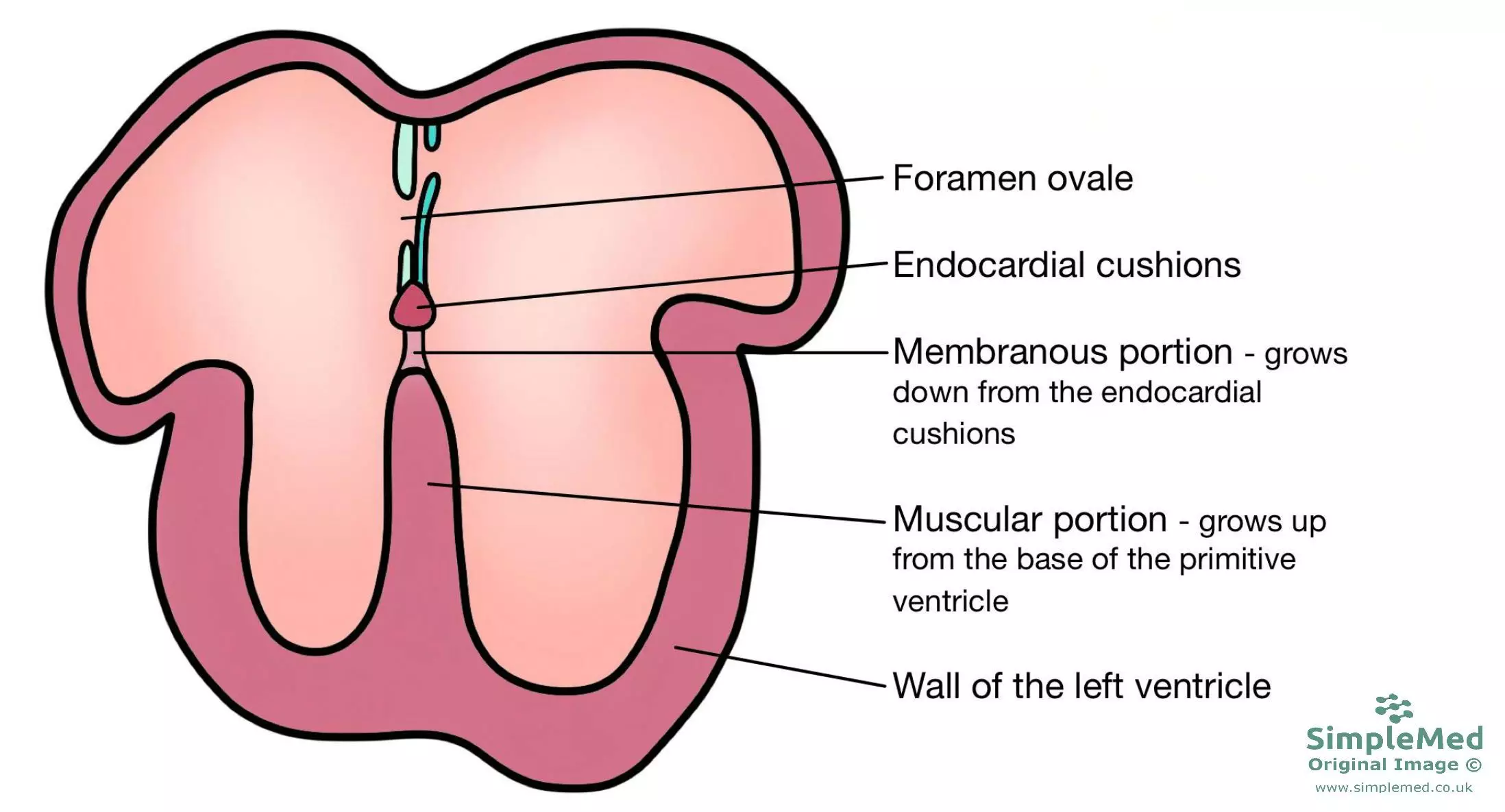Ventricular Septum Formation SimpleMed