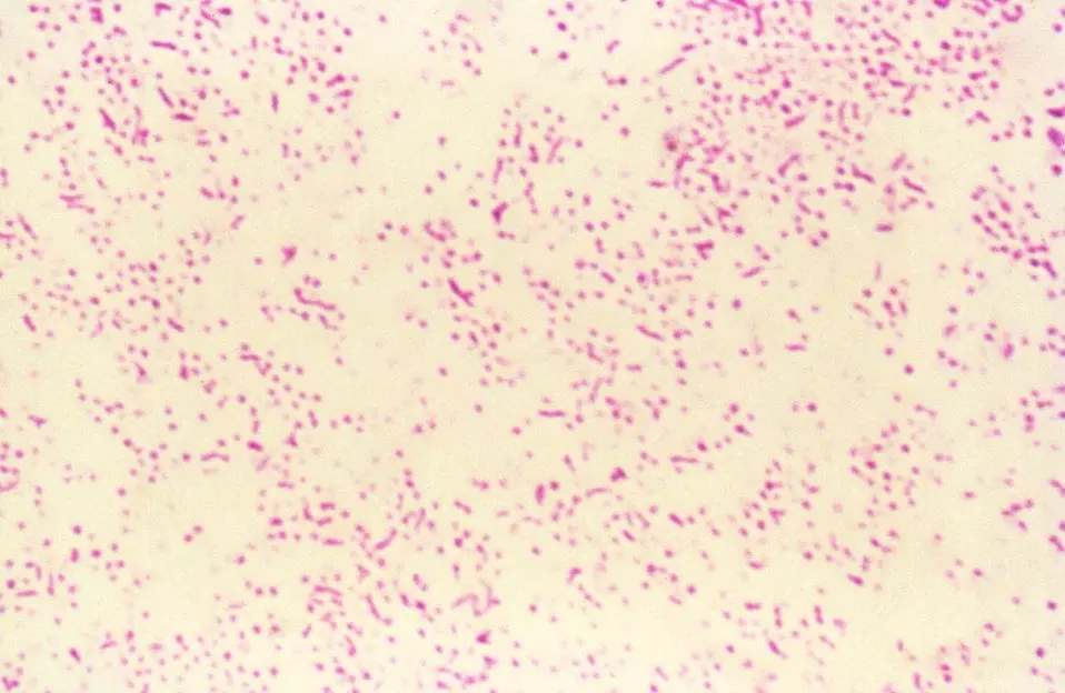 Campylobacter Jejuni Gram Stain SimpleMed