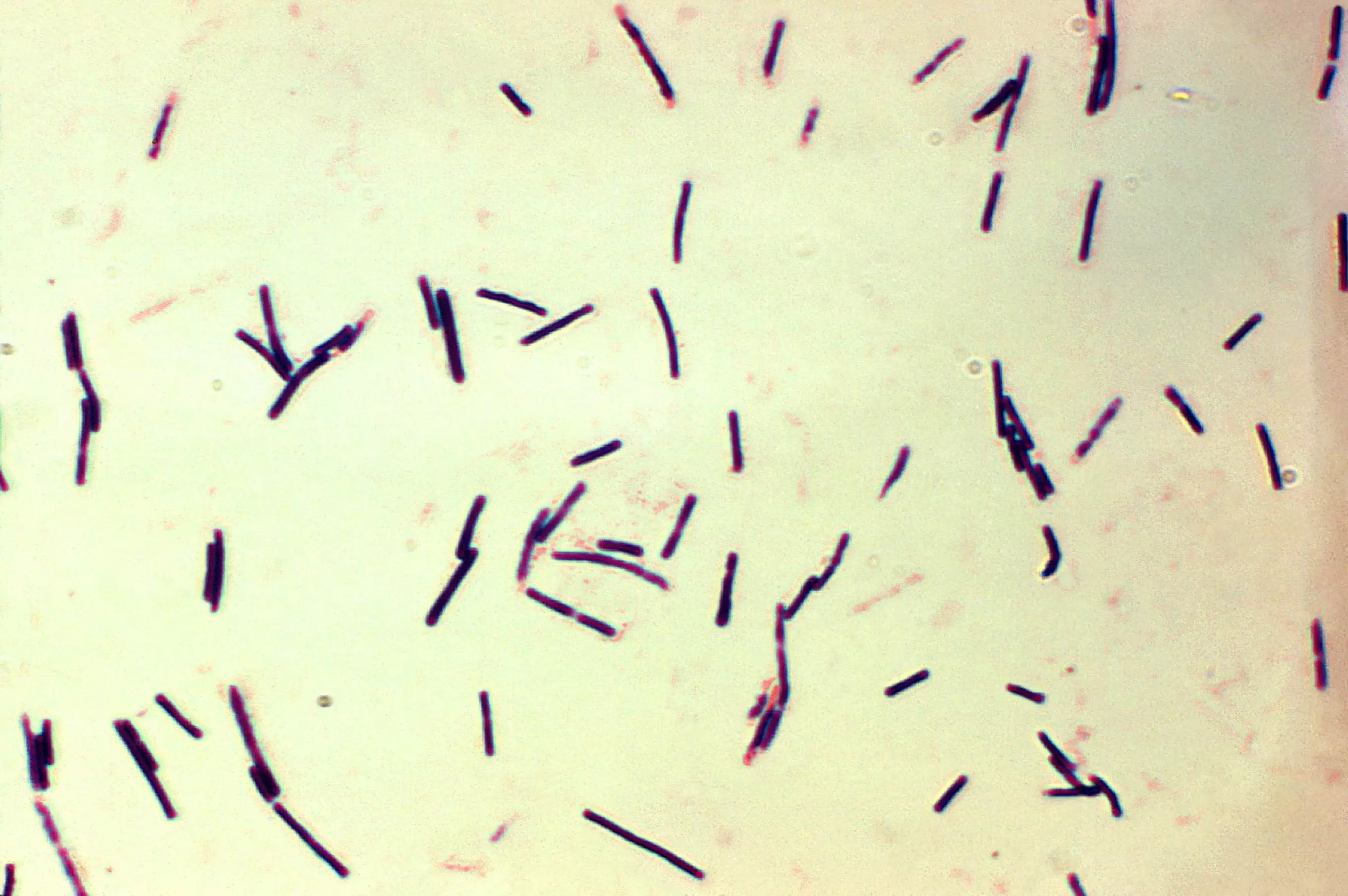 Clostridium Difficile Gram Stain SimpleMed