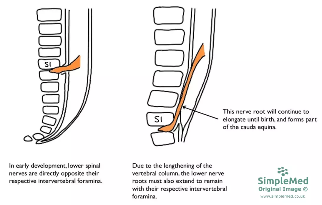Elongation of the Spinal Cord SimpleMed Elongation of the Spinal Cord SimpleMed