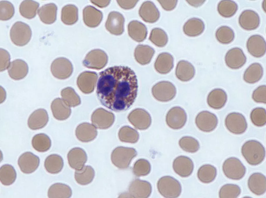 Eosinophil Histology SimpleMed Eosinophil Histology SimpleMed