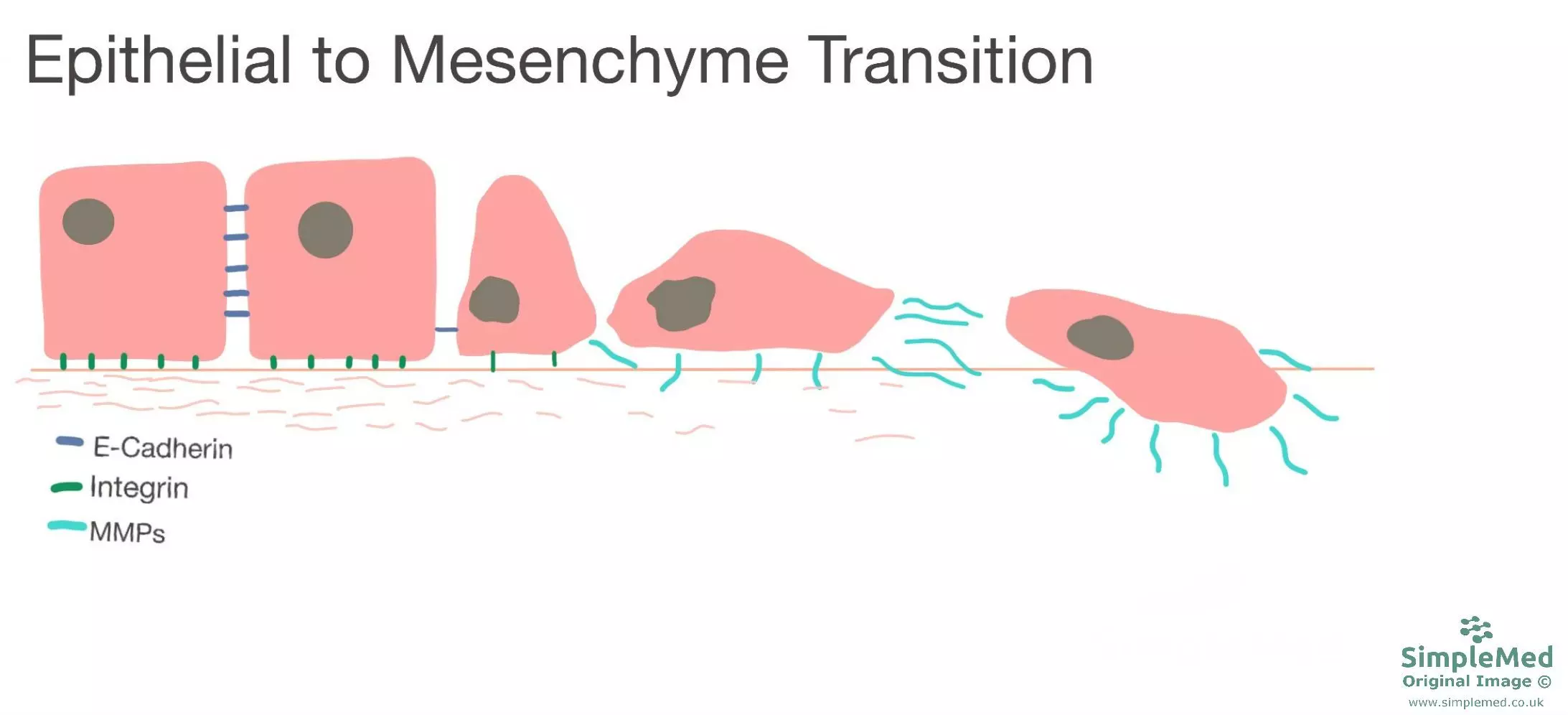 Epithelial to Mesenchyme Transition SimpleMed Epithelial to Mesenchyme Transition SimpleMed