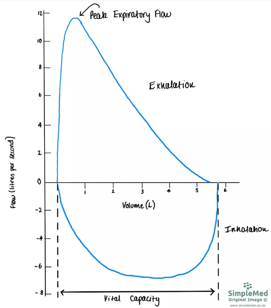 Normal Flow Volume Curve SimpleMed Normal Flow Volume Curve SimpleMed