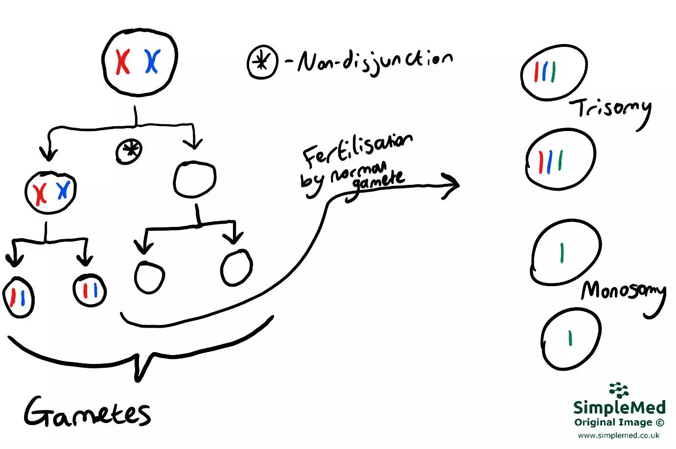 Non-disjunction in Meosis 1 SimpleMed Non-disjunction in Meosis 1 SimpleMed