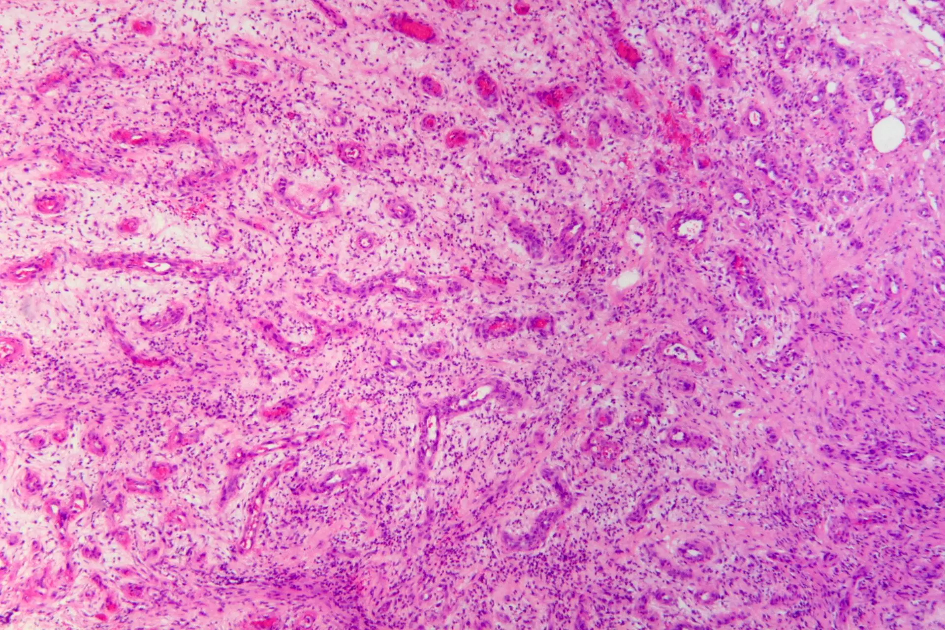 Histology of Granulation Tissue SimpleMed Histology of Granulation Tissue SimpleMed