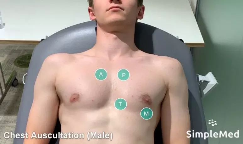 Heart Valve Locations SimpleMed Heart Valve Locations SimpleMed