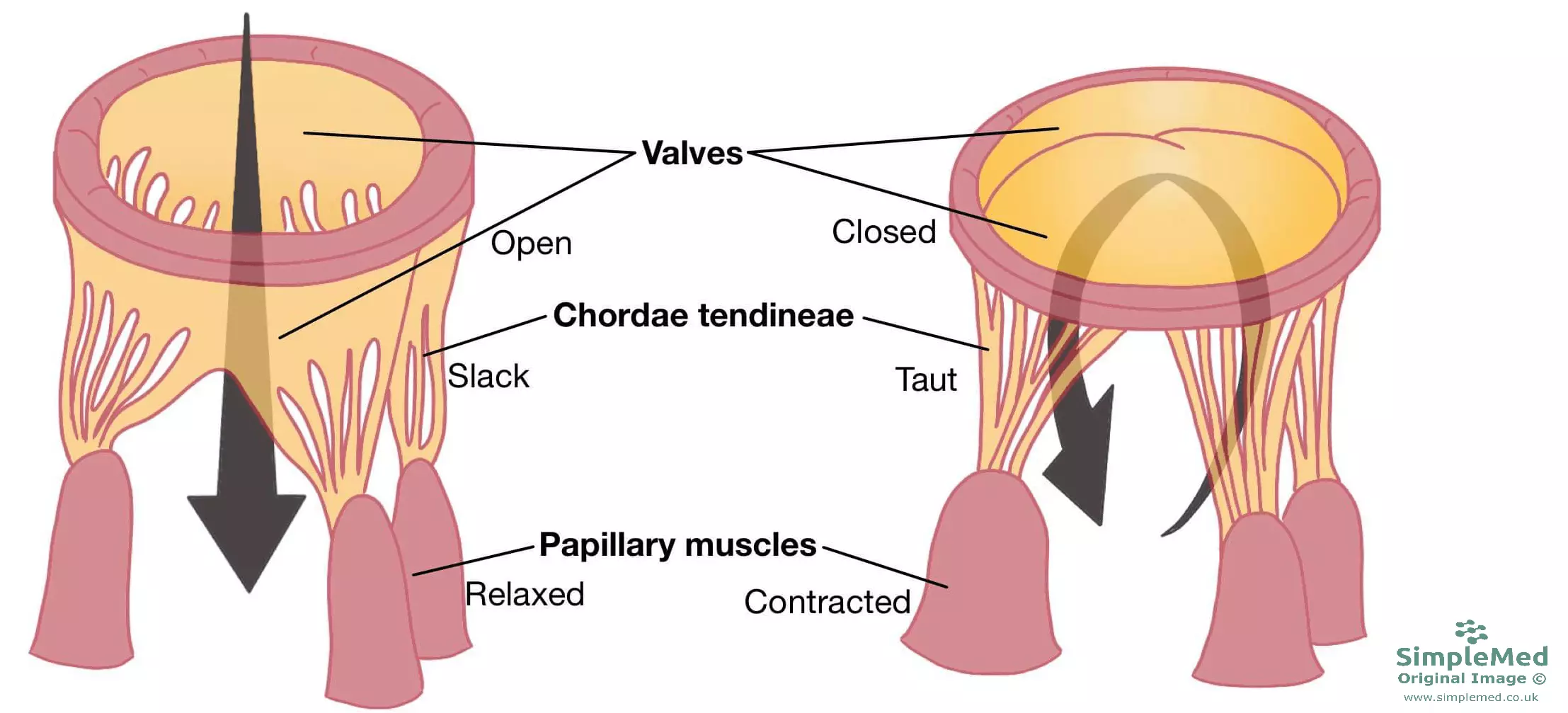 Valves of the Heart and chordae tendineae SimpleMed Valves of the Heart and chordae tendineae SimpleMed