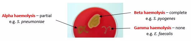 Streptococcal Haemolytic Patterns SimpleMed Streptococcal Haemolytic Patterns SimpleMed