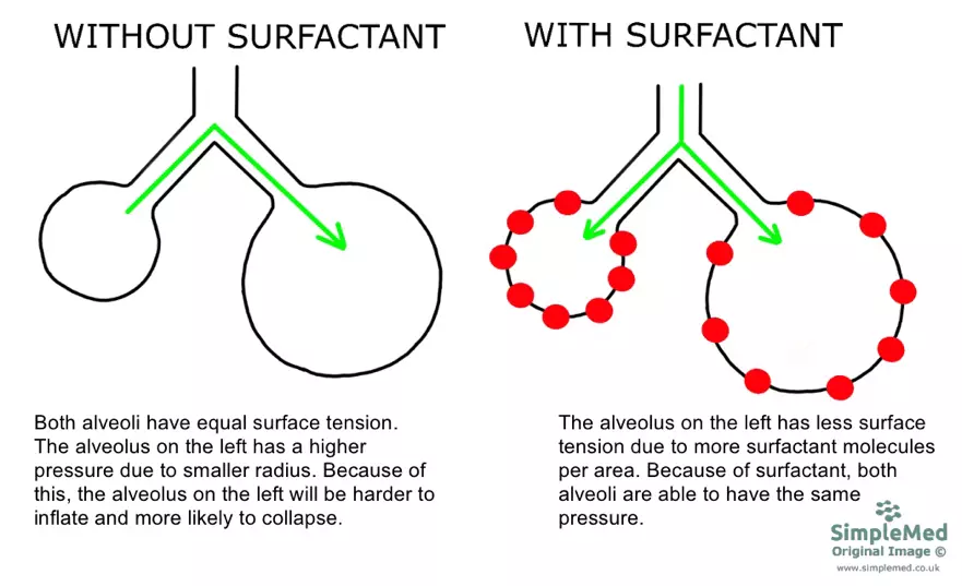 Surfactant Effect on Lung Stabilisation SimpleMed Surfactant Effect on Lung Stabilisation SimpleMed