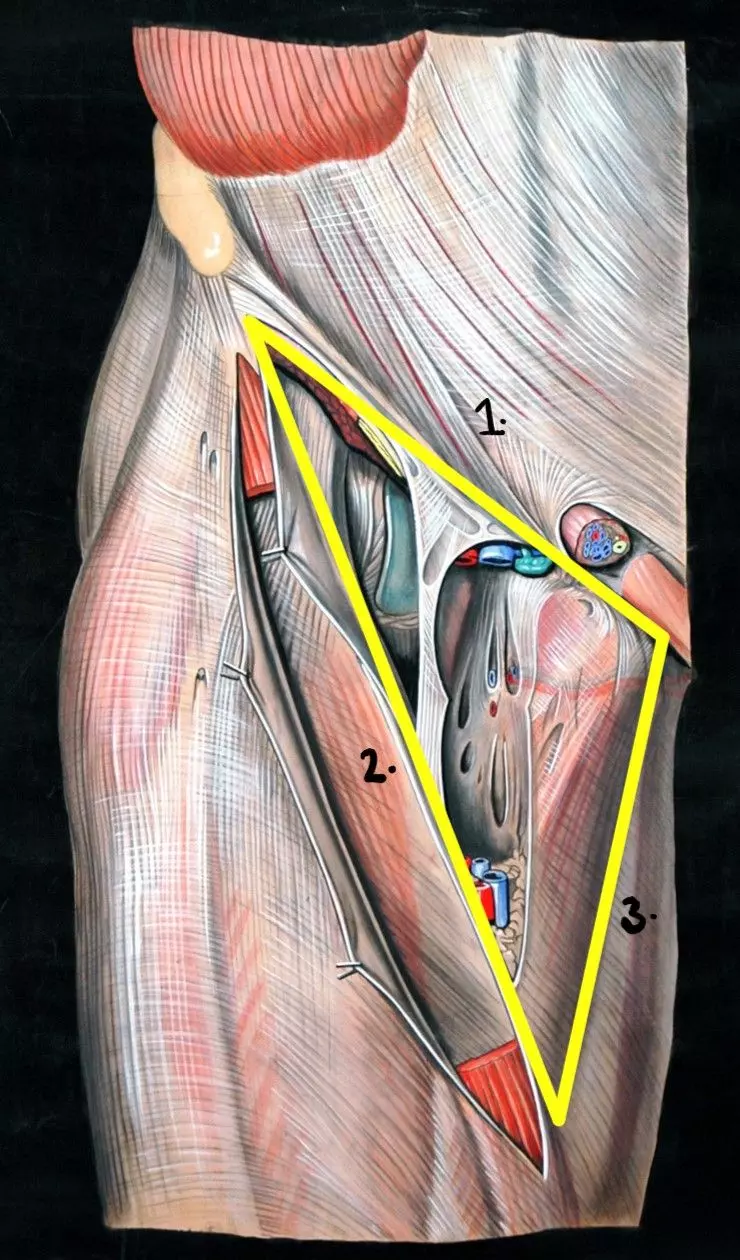 The Femoral Triangle SimpleMed The Femoral Triangle SimpleMed