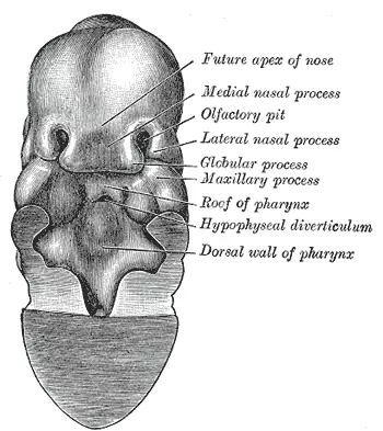 Medial and Lateral Nasal Prominences SimpleMed Medial and Lateral Nasal Prominences SimpleMed