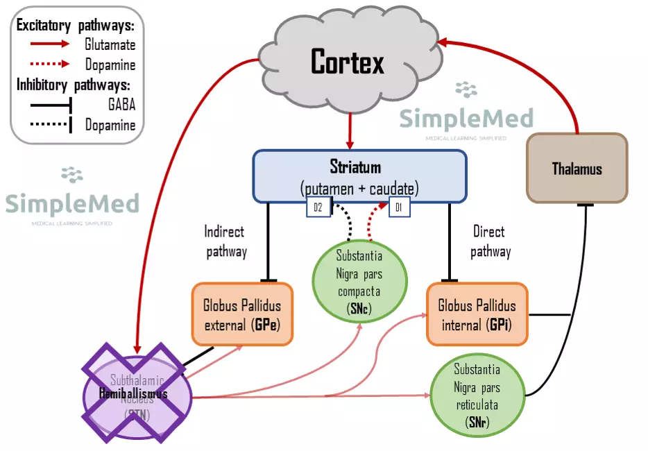 Motor Pathway in Hemiballismus SimpleMed Motor Pathway in Hemiballismus SimpleMed