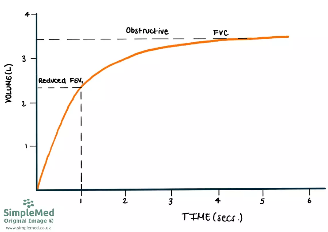Obstructive Time Volume Graph SimpleMed Obstructive Time Volume Graph SimpleMed