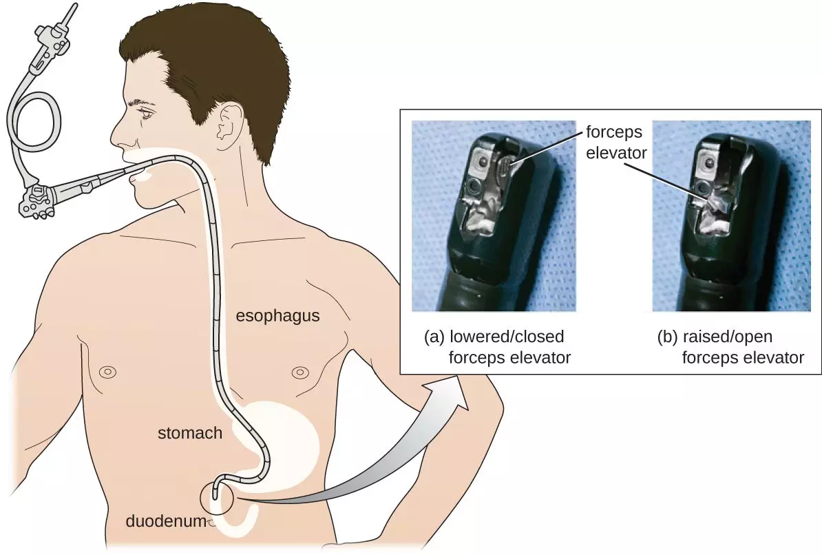 Oesophagogastroduodenoscopy Process SimpleMed Oesophagogastroduodenoscopy Process SimpleMed
