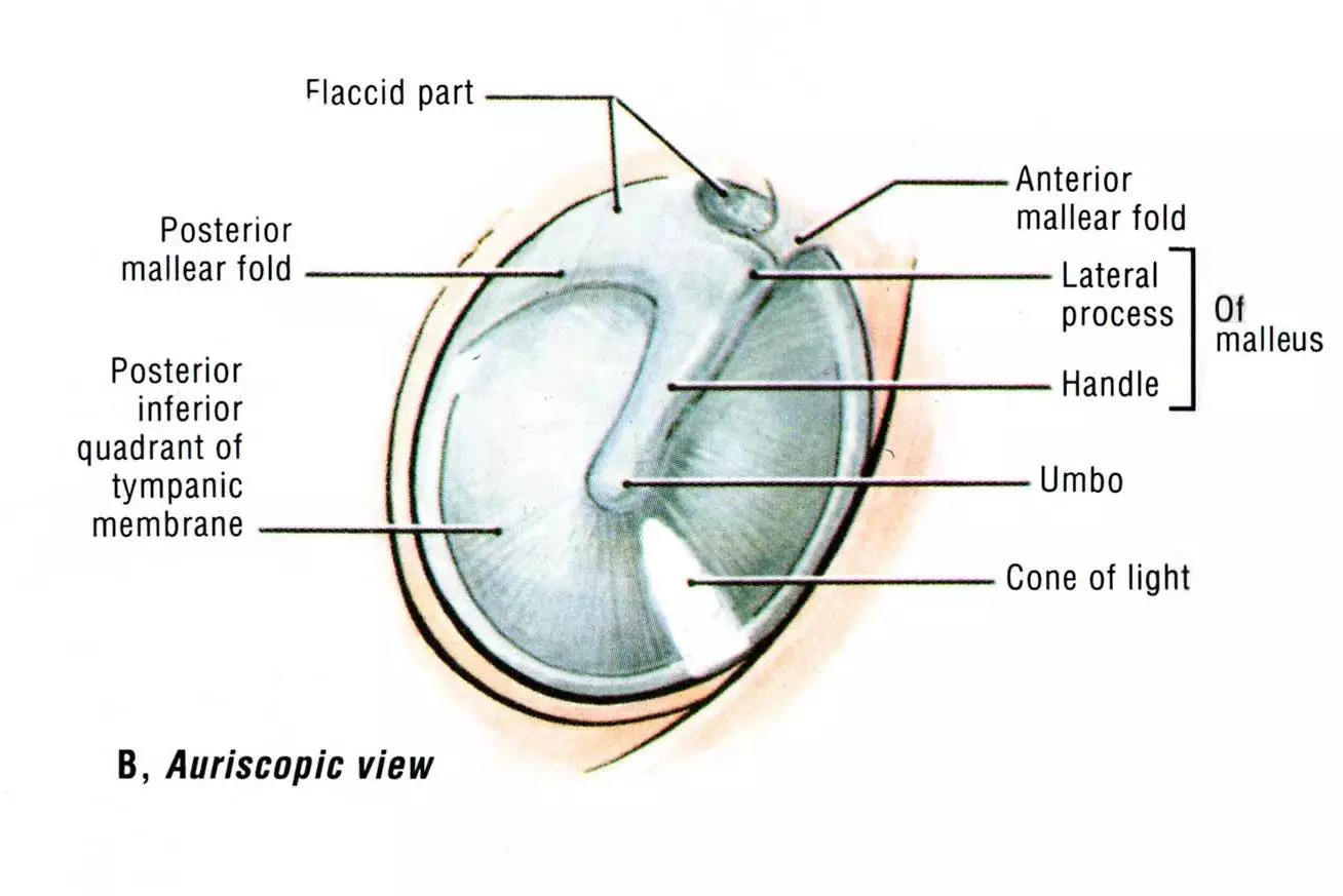 Otoscope of the Tympanic Membrane SimpleMed Otoscope of the Tympanic Membrane SimpleMed
