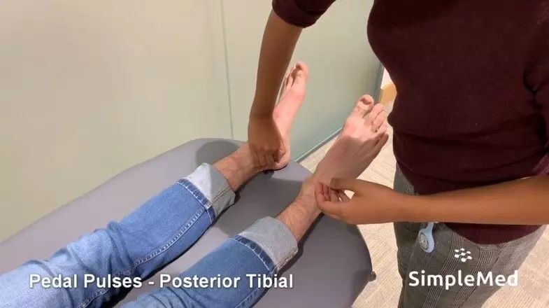 Posterior Tibial Pulse SimpleMed Posterior Tibial Pulse SimpleMed
