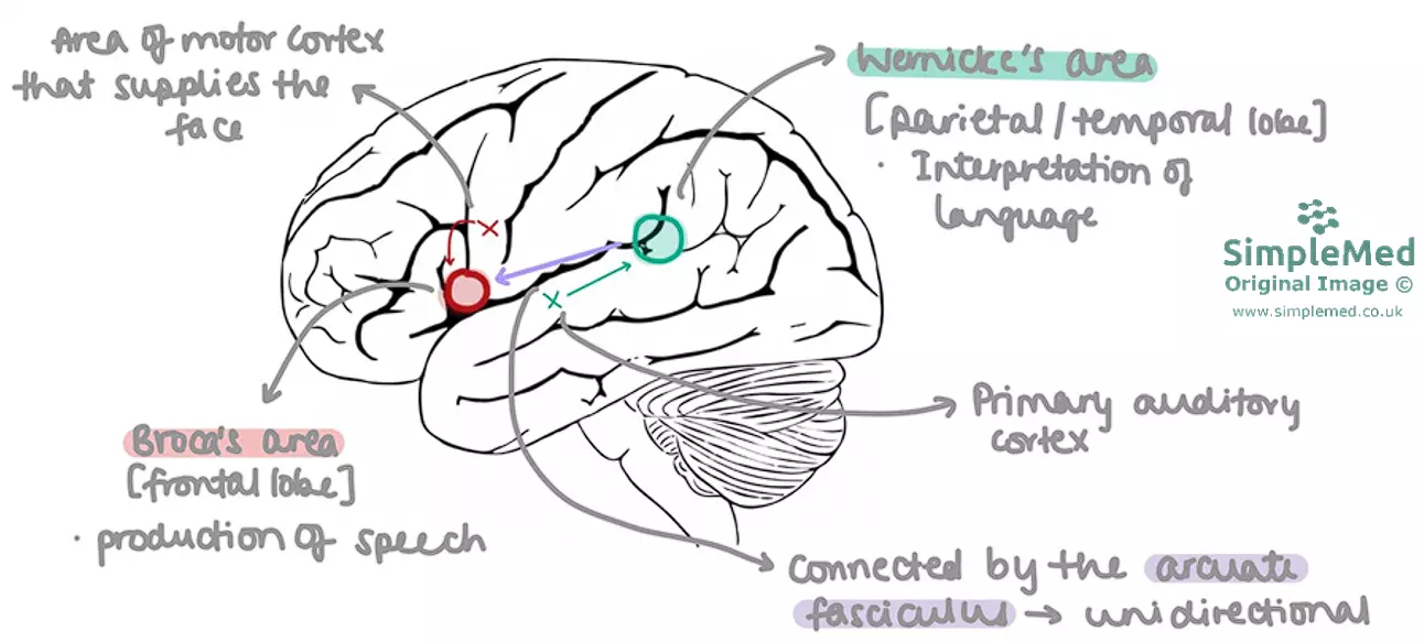 Pathway for Repeating a Heard Word SimpleMed Pathway for Repeating a Heard Word SimpleMed