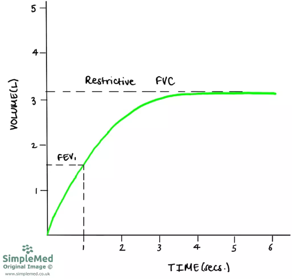 Restrictive Time Volume Graph SimpleMed Restrictive Time Volume Graph SimpleMed