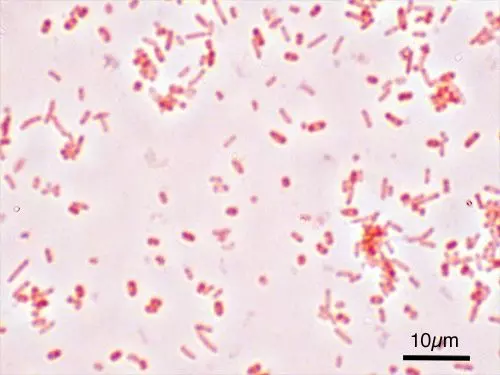 Salmonella Typhi Gram Stain SimpleMed