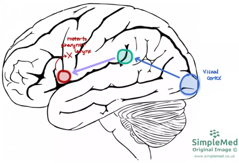 Pathway for Speaking a Written Word SimpleMed Pathway for Speaking a Written Word SimpleMed
