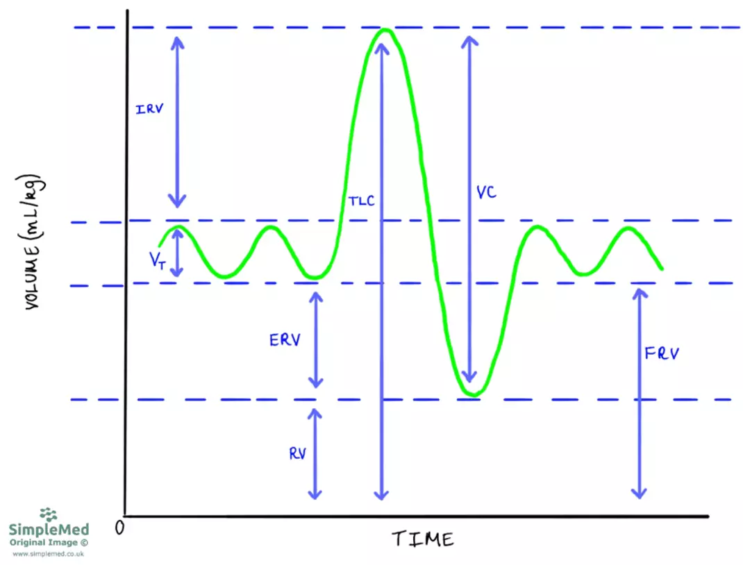 Spirometry Trace SimpleMed Spirometry Trace SimpleMed