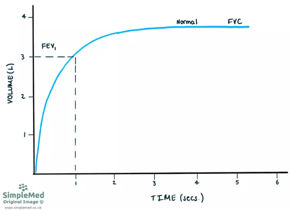 Normal Time Volume Graph SimpleMed Normal Time Volume Graph SimpleMed