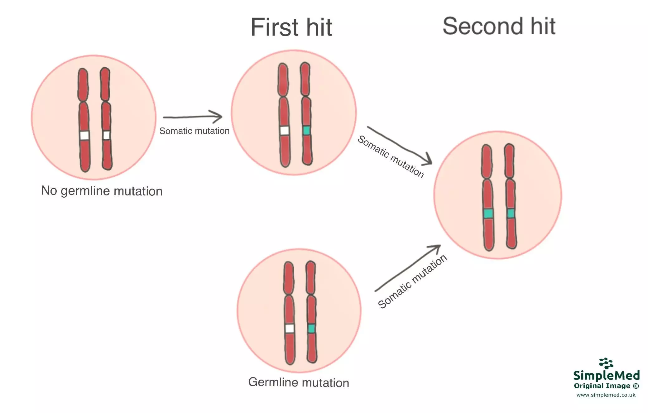 Two Hit Cancer Hypothesis SimpleMed Two Hit Cancer Hypothesis SimpleMed